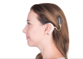 implante coclear perdida auditivo logopedia